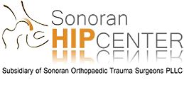 Sonoran Hip Center